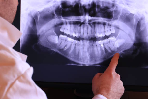 Best Emergency Dental Extractions in Citrus City, TX