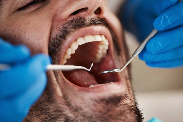 Best Emergency Dentist for Knocked-Out Tooth in Citrus City, TX